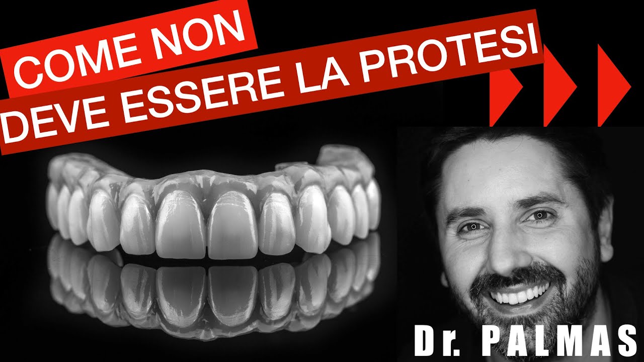 Dr Palmas - Attenti al design della Protesi avvitata sugli impianti