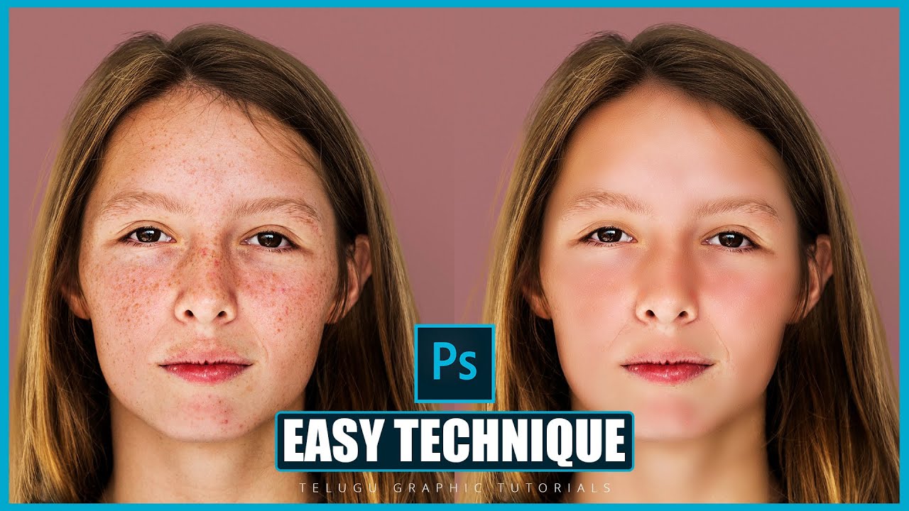 Face Retouching in Photoshop | Best Skin Retouching Tutorial in telugu
