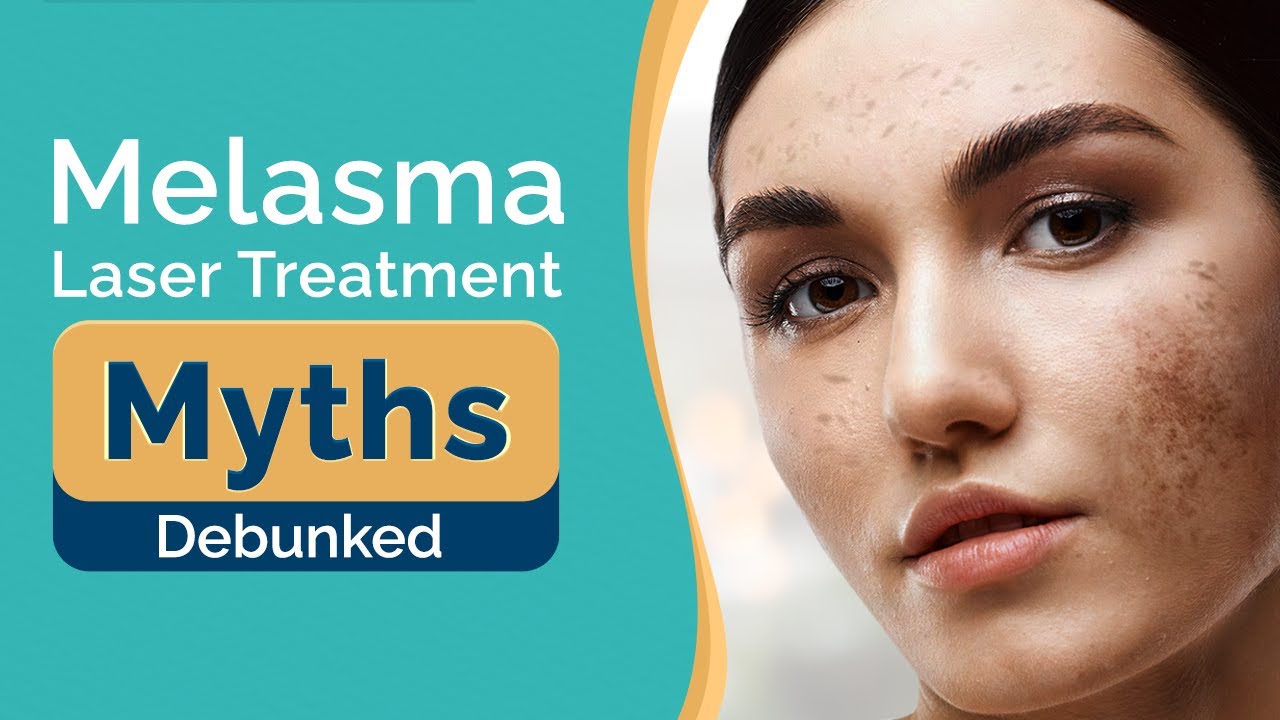 Myth vs. Reality: Melasma Laser Treatment Exposed | Melasma Treatment | Dr. Jangid | SkinQure