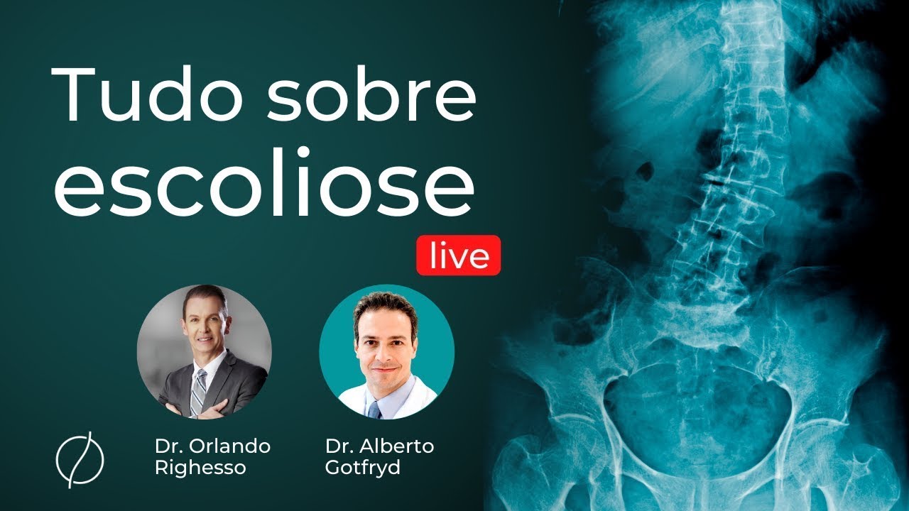 Tudo sobre escoliose, live com a Sociedade Brasileira de Coluna - Médico Especialista em Coluna