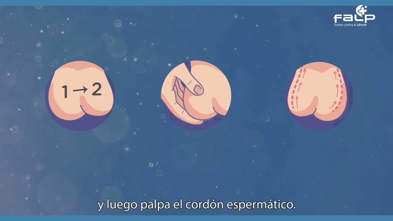 Cáncer Testicular
