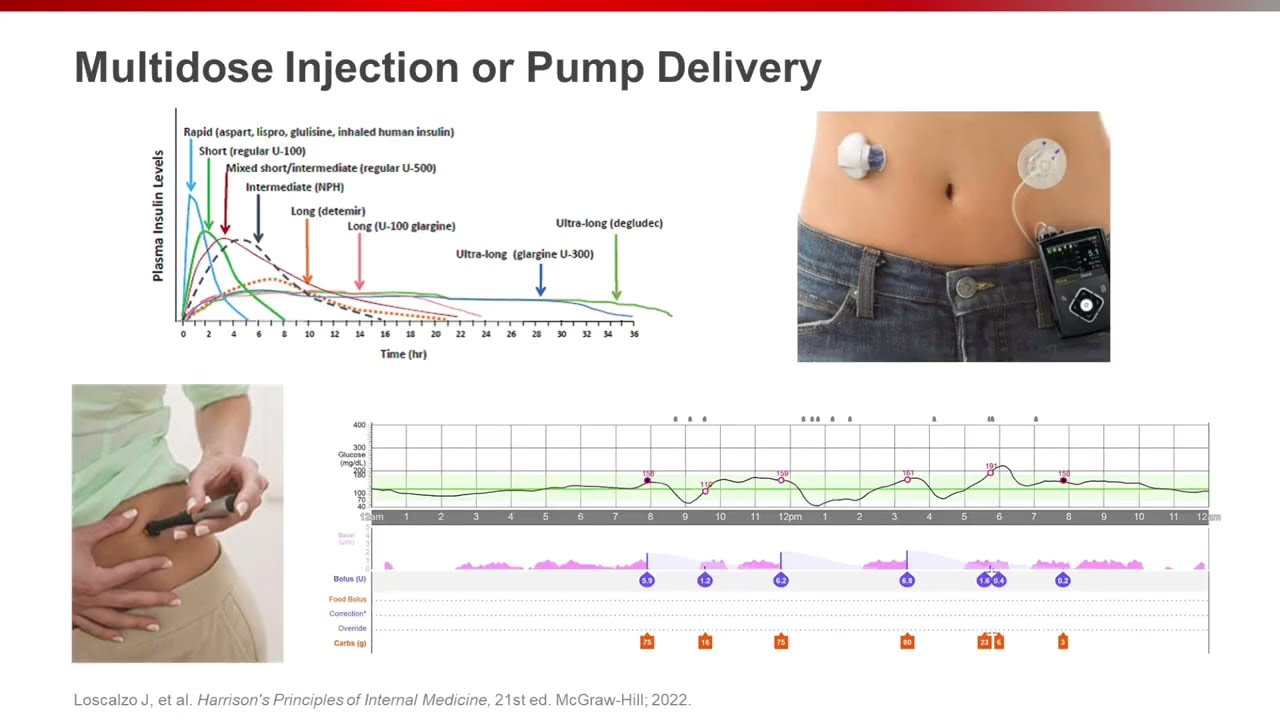 T1D Pathophysiology and Disease Management: What We Currently Know