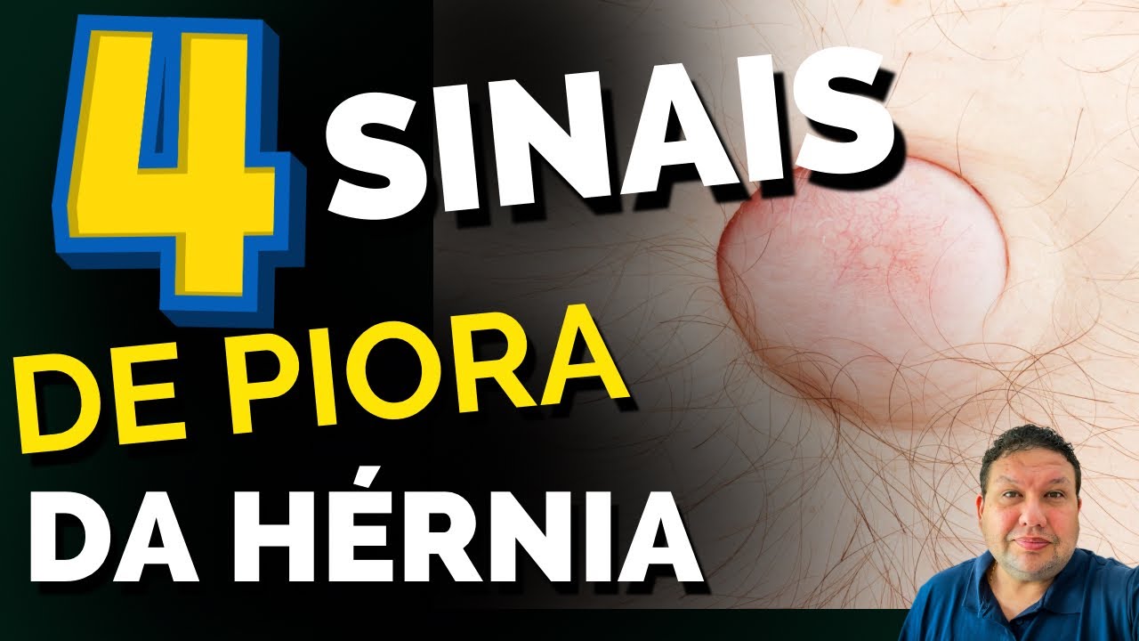 4 sinais de que sua hérnia está ficando perigosa.