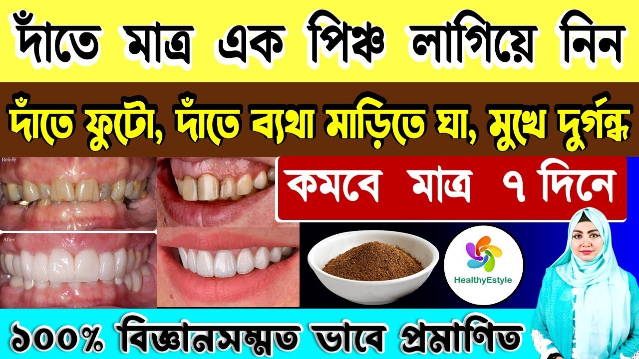 দাঁত ব্যাথার প্রাকৃতিক সমাধান | Natural Home made herbal powder for tooth problem. | HealthyEstyle