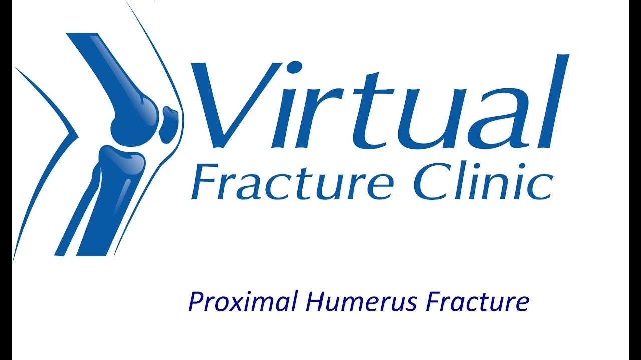 Proximal Humerus Fracture