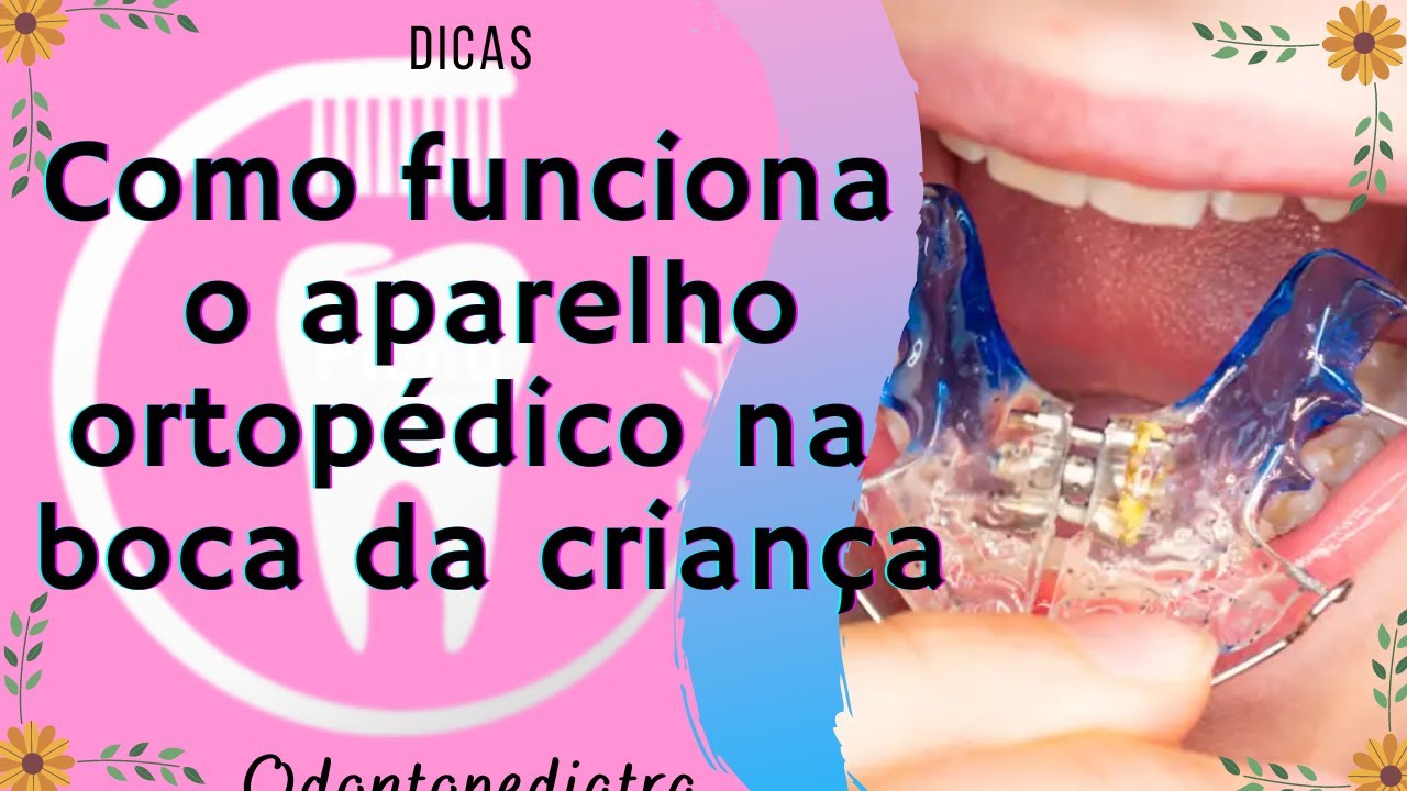 Como funciona o aparelho ortopédico na boca da criança?
