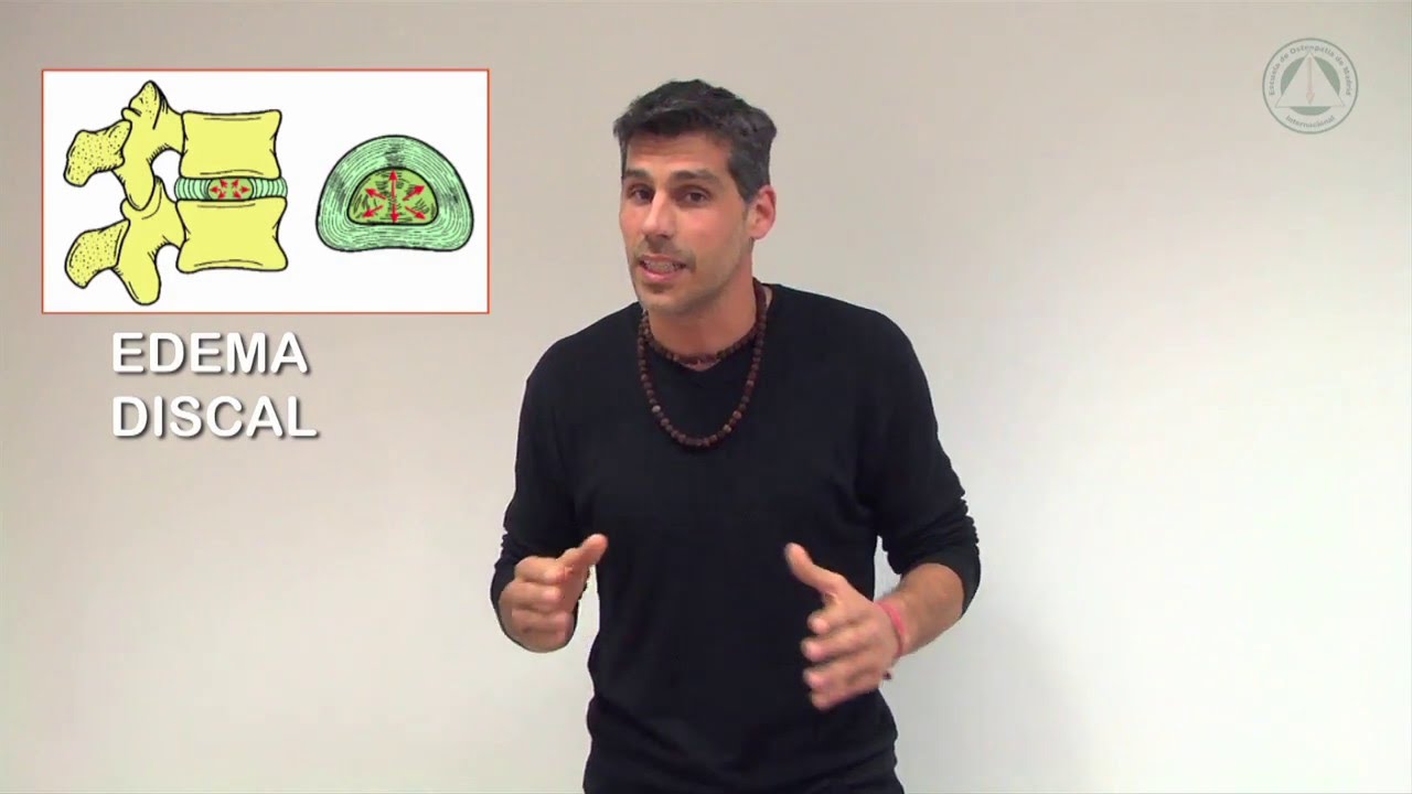 TRATAMIENTO OSTEOPÁTICO DE LAS LESIONES DISCALES