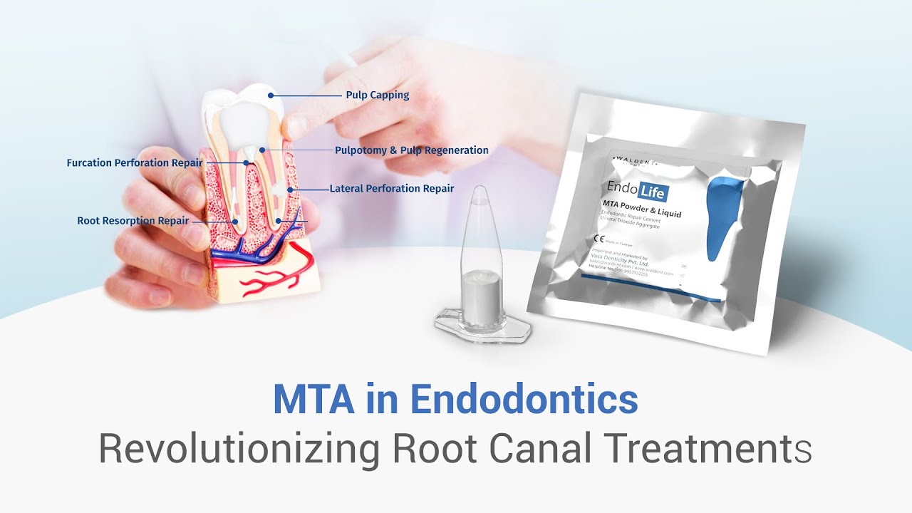 ROLE OF MTA IN ENDODONTICS #dental #dentalkart #waldentMTA #EndolifeMTA