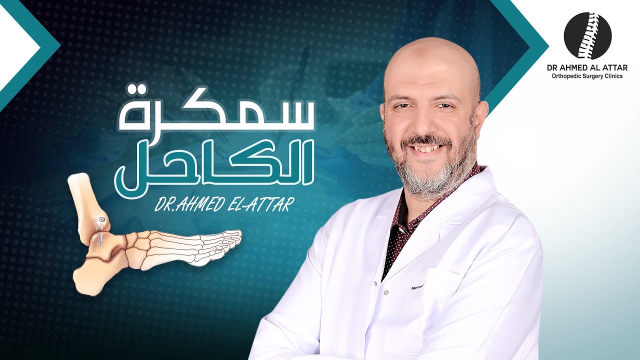 سمكرة الكاحل بالتفصيل للدكتور احمد العطار