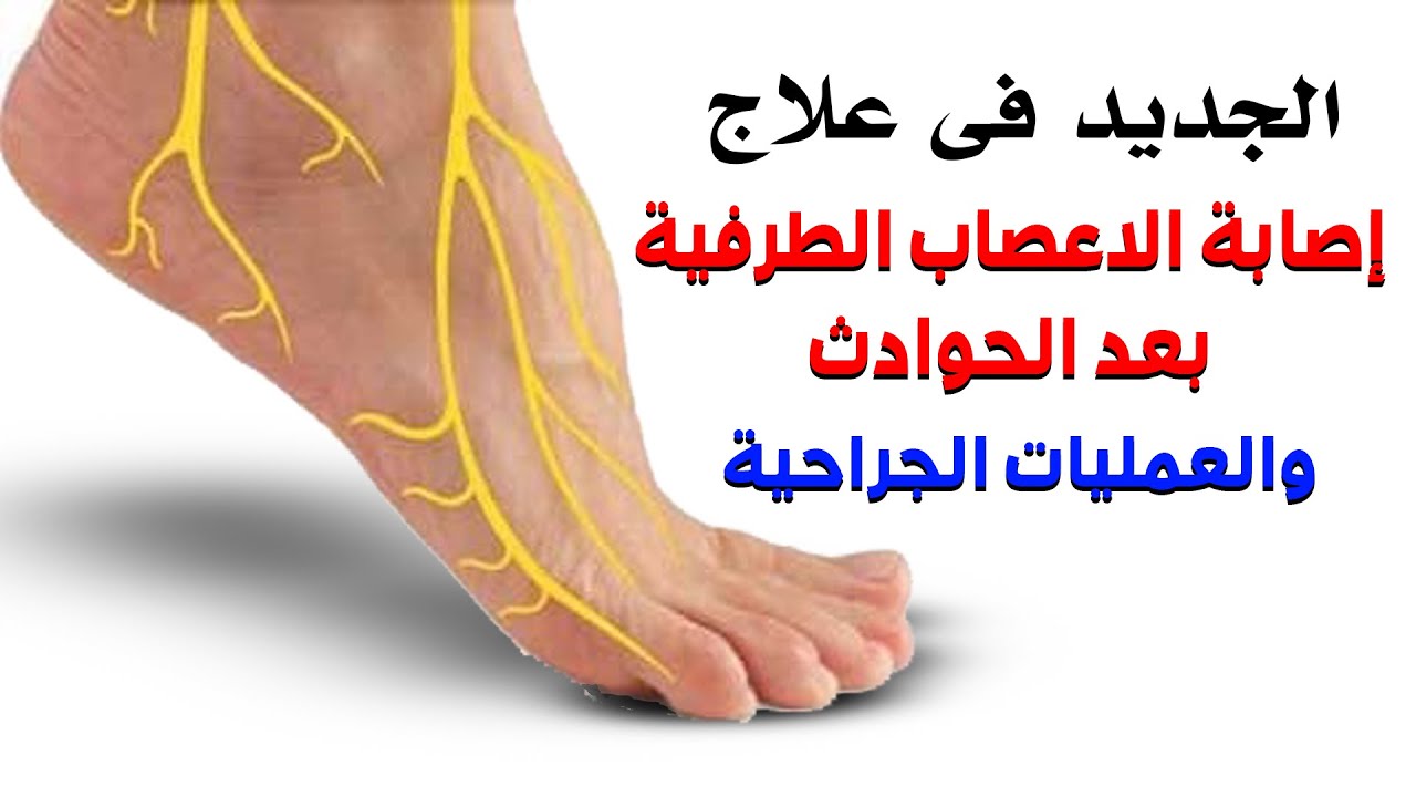 الجديد فى علاج إصابة الاعصاب الطرفية بعد الحوادث والعمليات الجراحية.|ا.د محمد حمادة استاذ علاج الالم