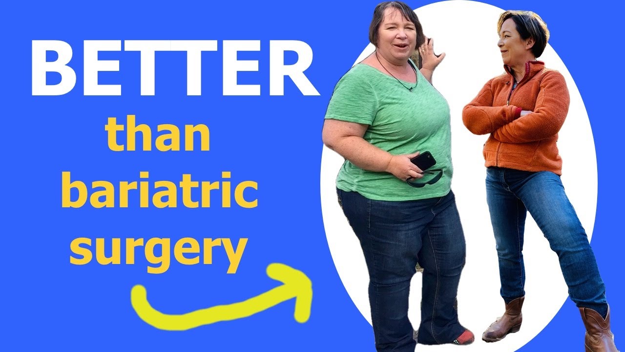 Bariatric Surgery - I Didn't Need Gastric Sleeve, Down 140lbs in Surprising Success Story