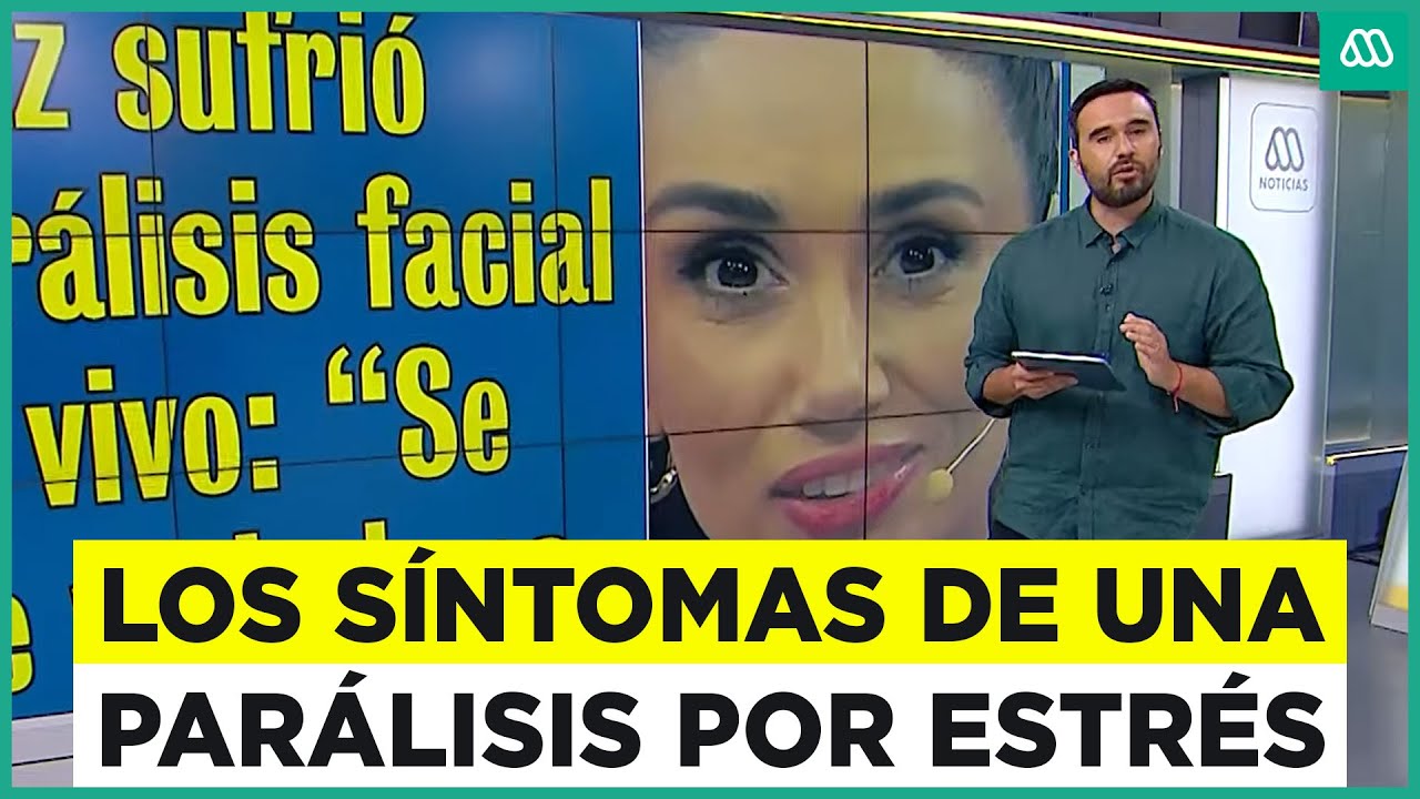 Estos son los síntomas de una parálisis facial por estrés