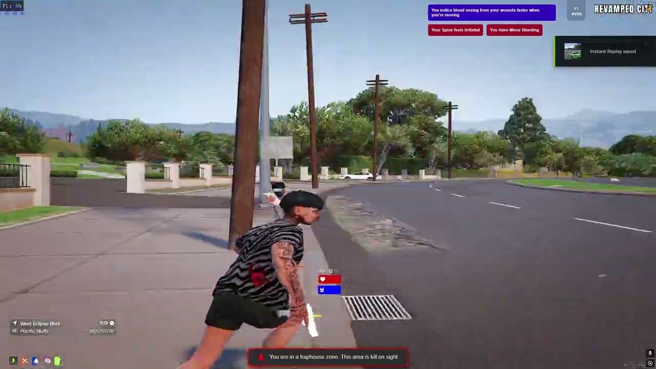 xd