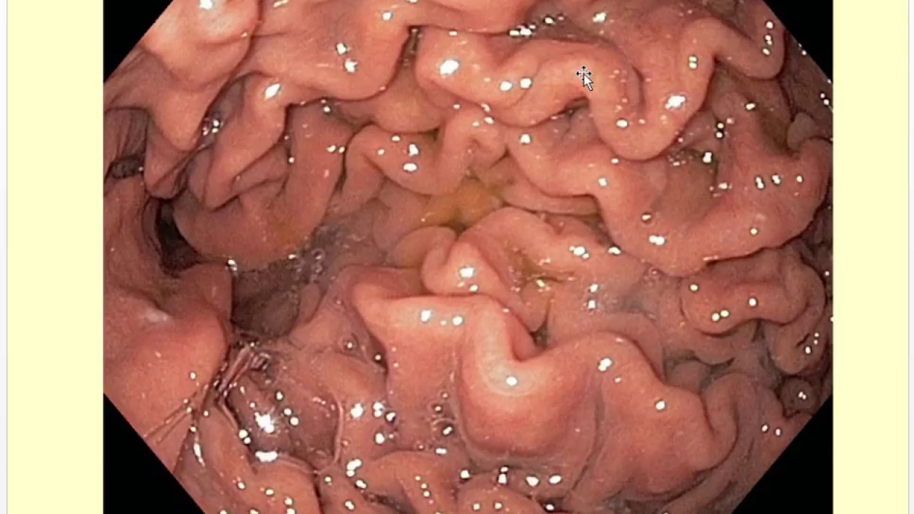 Stomach Anatomy and Histology Review: part 5 of the makeup lecture