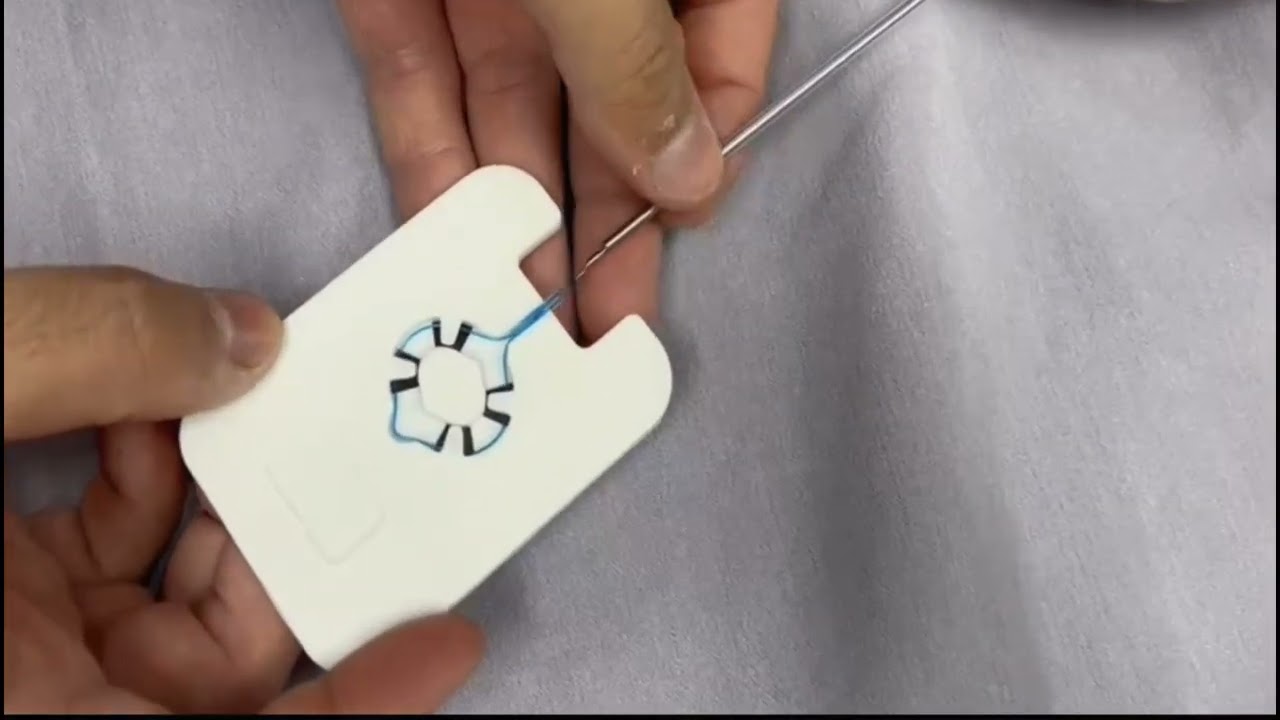 como cargar un endoloop endosc&oacute;pico (how to assemble an endoscopic endoloop)