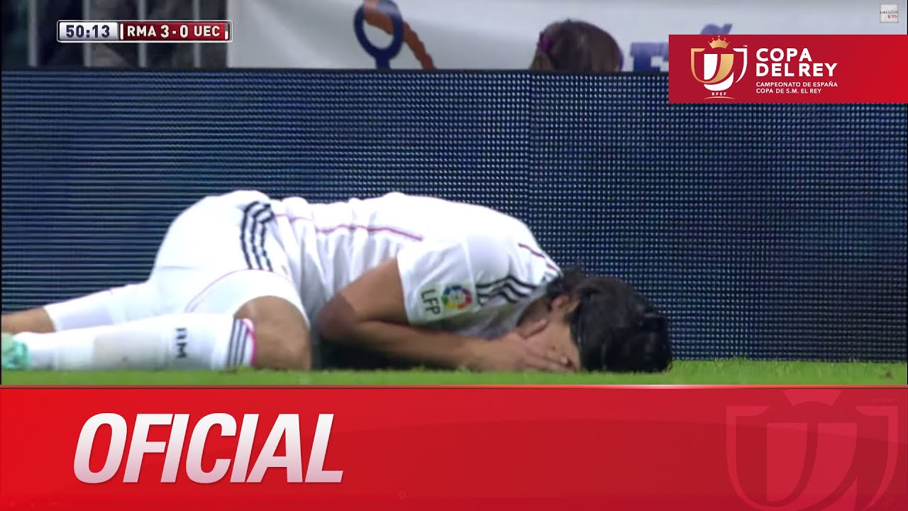 Khedira aturdido por un golpe en la cara. Cambio por Jesé Copa del Rey