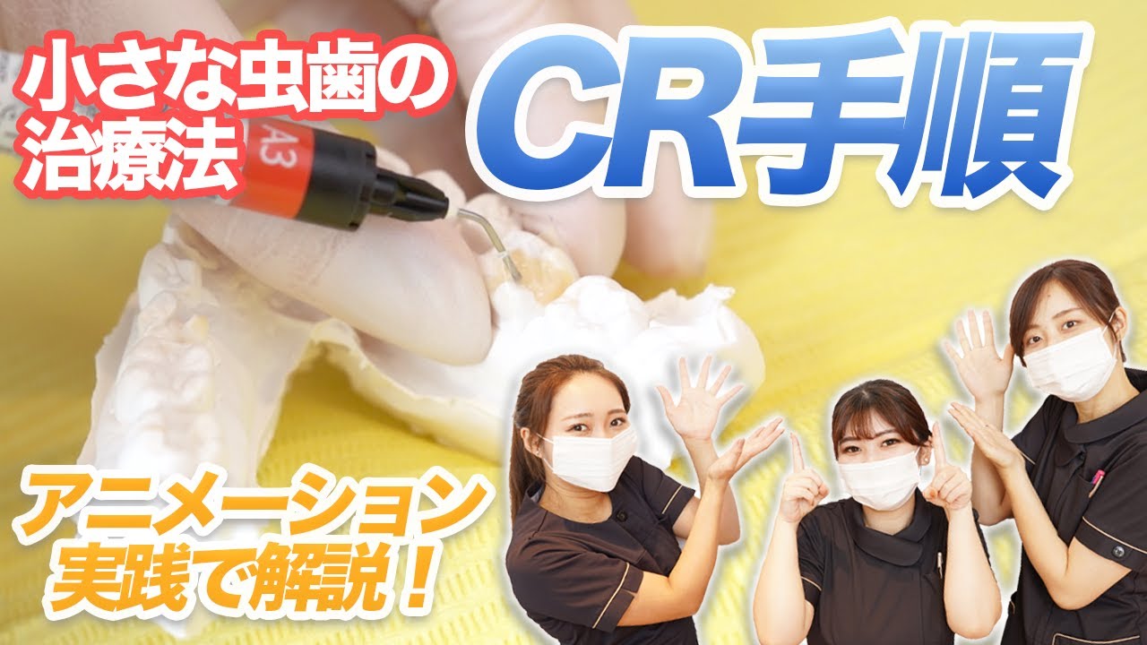 【CR手順】小さい虫歯ってどうやって治療するの？【名古屋茶屋歯科・矯正歯科】