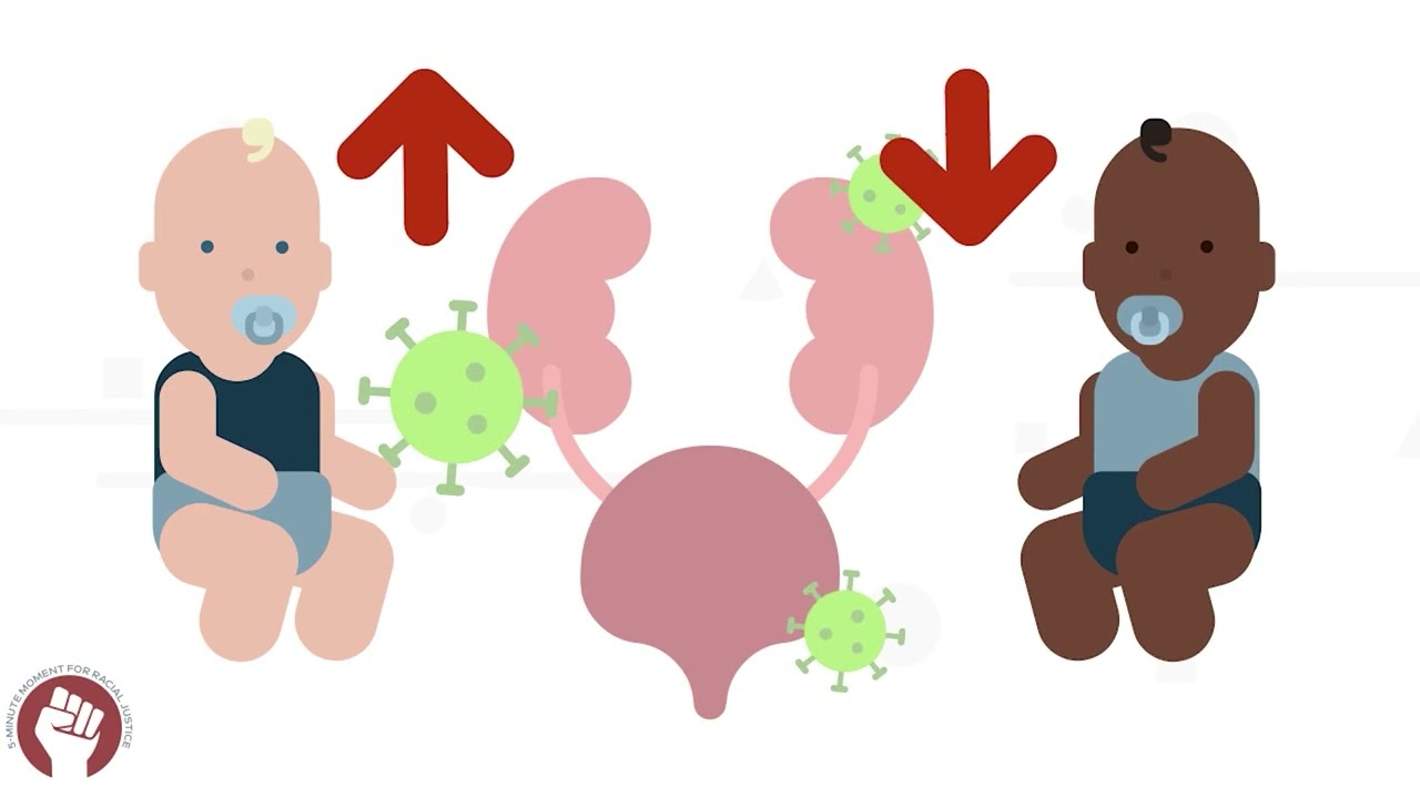 Race Correction in the Pediatric UTI Guidelines_45723