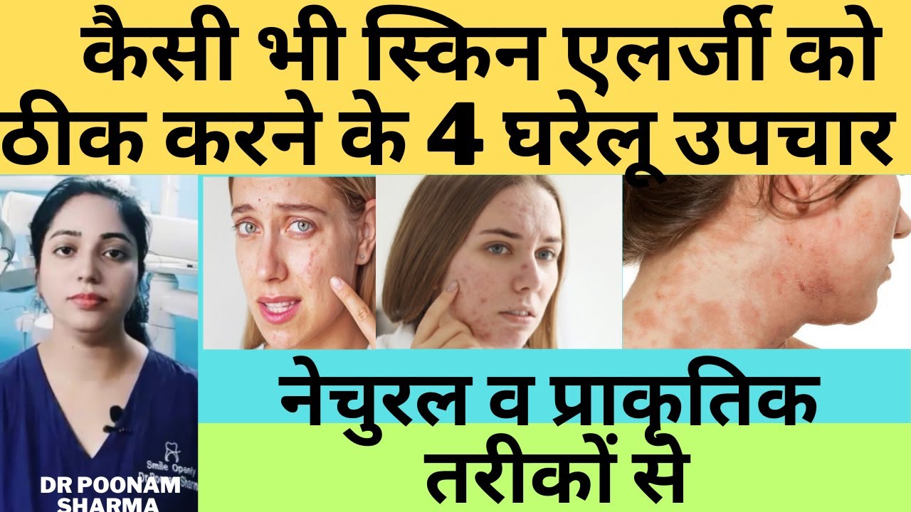 4 Effective Home Remedies For Skin Allergy #skinallergy