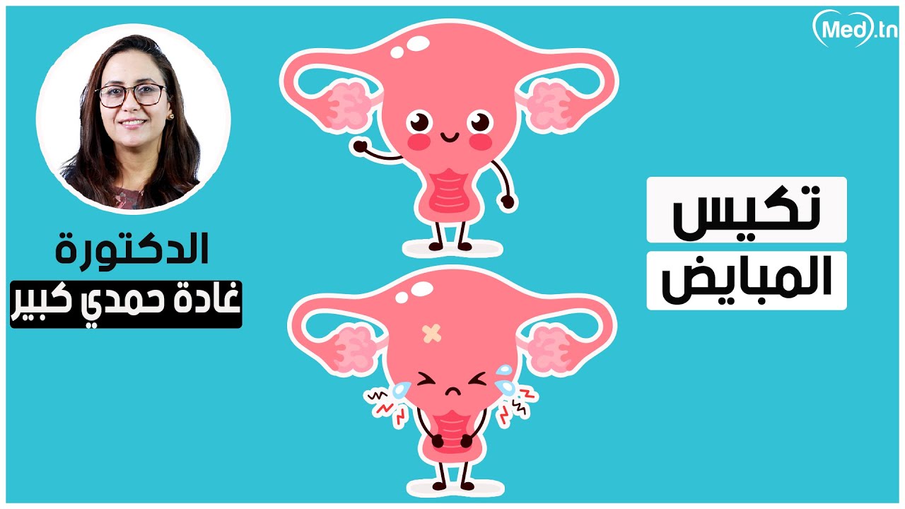 تكيس المبايض | الدكتورة غادة حمدي كبير