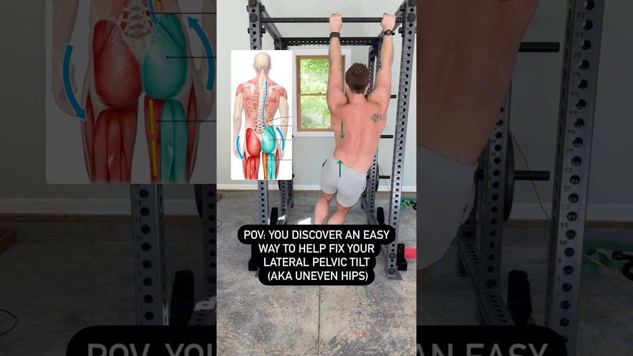 POWERFUL Lateral Pelvic Tilt Correction Exercise