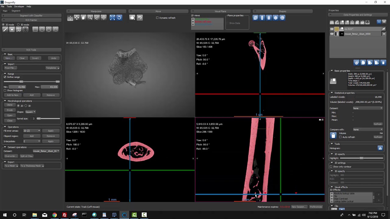 Dragonfly3.6 Tutorial - ROI Interpolate