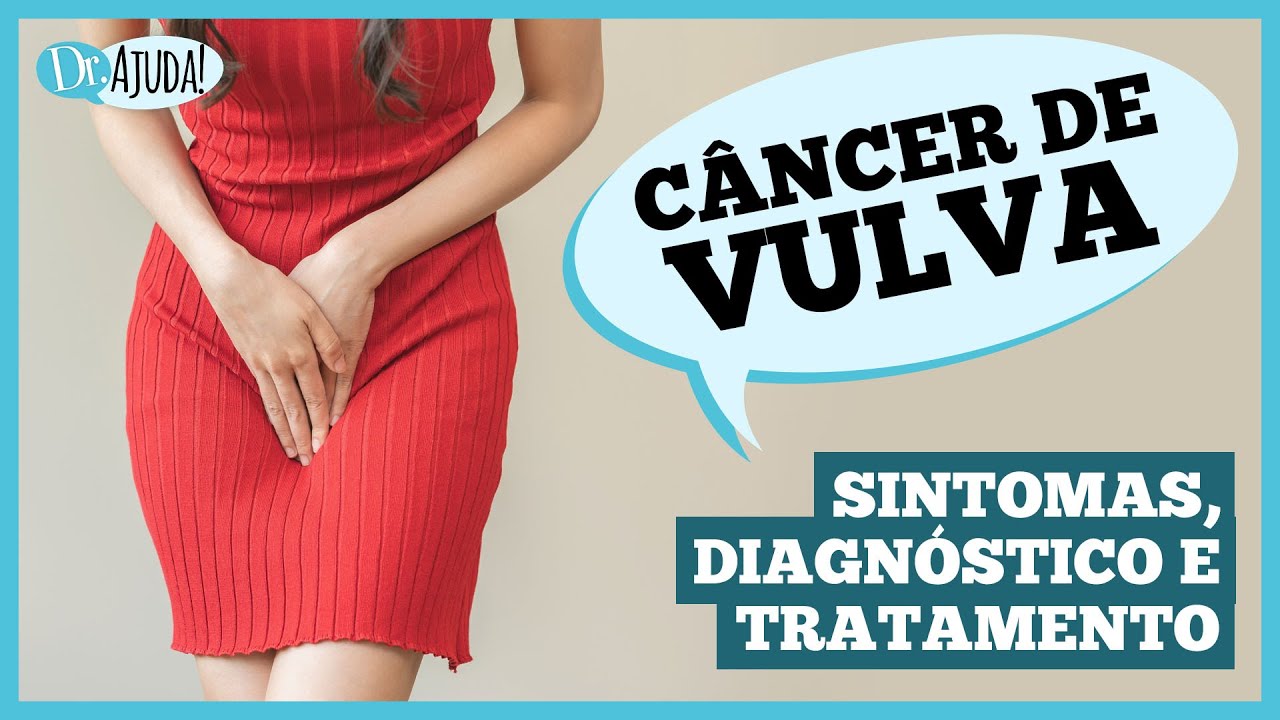 Já ouviu falar de CÂNCER DE VULVA? Caroço, coceira e feridas podem ser os sintomas #saudedamulher