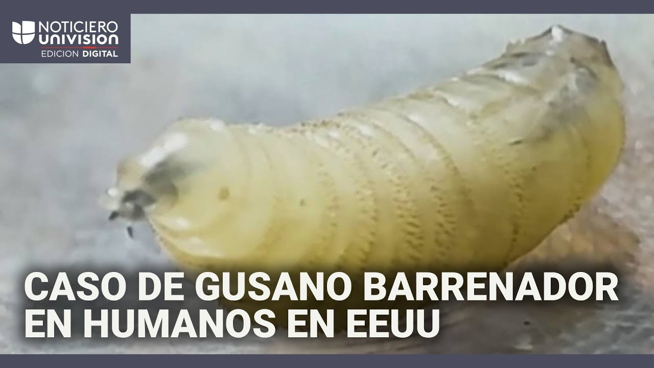 Primer caso de un humano infestado por el gusano barrenador en EEUU: ¿cómo actúa este parásito?