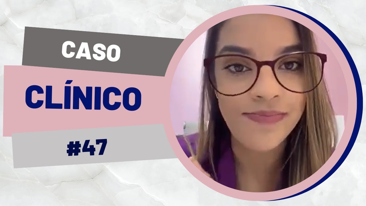 Caso clínico: fechamento de espaços de dentes perdidos | Indiara Dentista #47