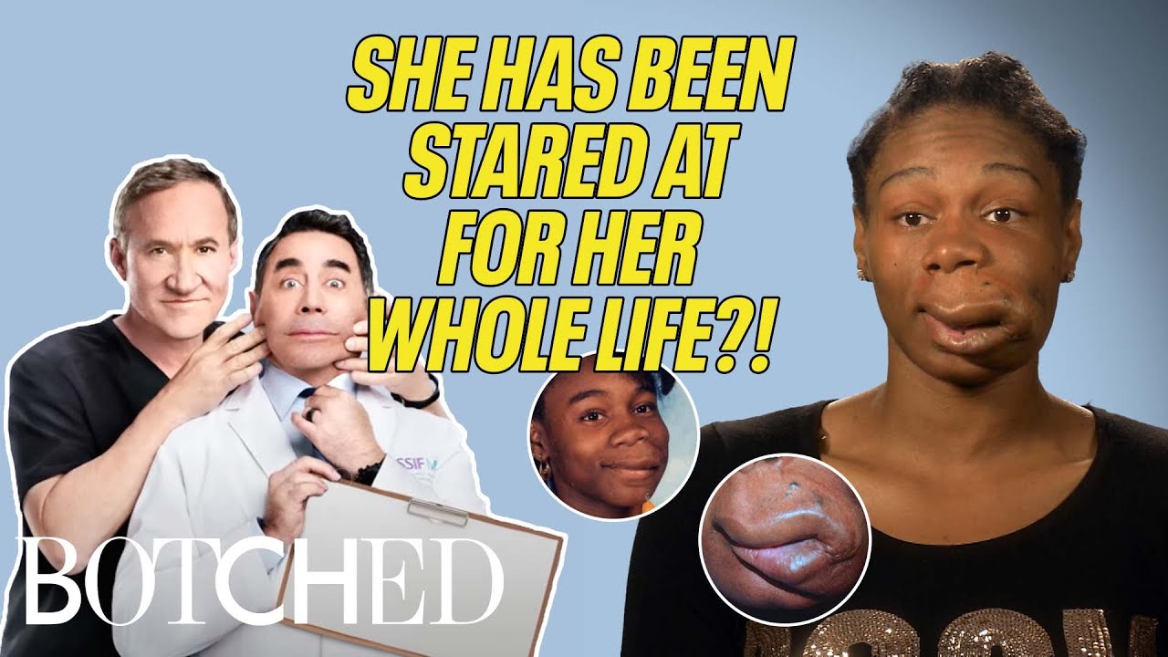 Starrina Was DISCRIMINATED Against for Her Lip Malformation (Before & After) | Botched | E!