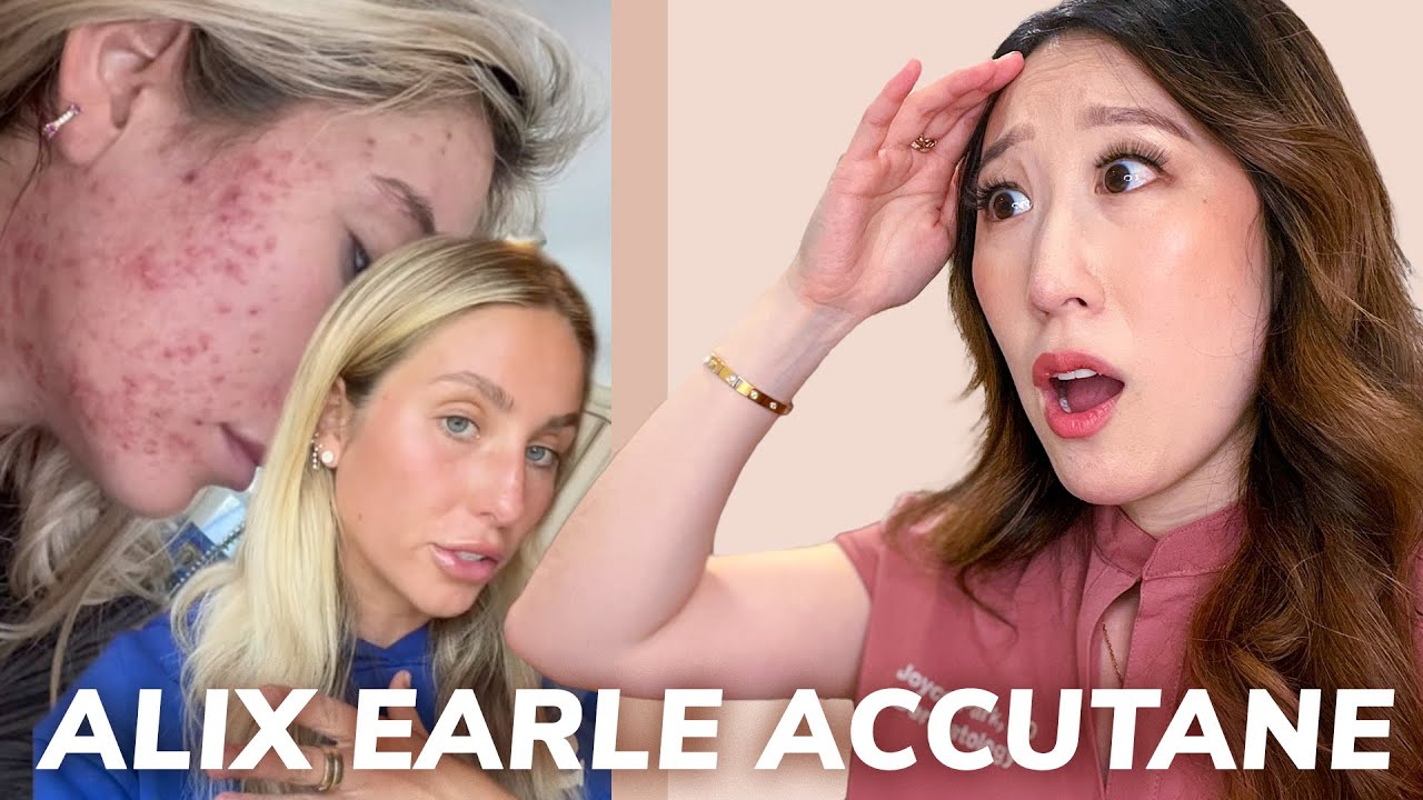 Dermatologist Reacts to Accutane Journey from Alix Earle | Side Effects, Hair Loss, Acne Recurrence