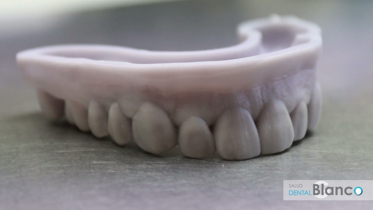 Carillas dentales de Salud Dental Blanco