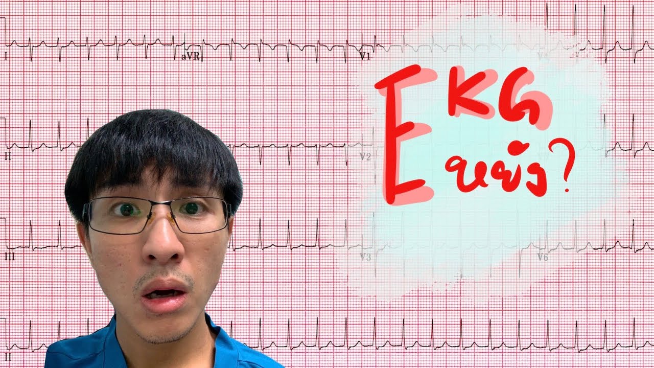 EKG Eหยังวะ (AVNRT)