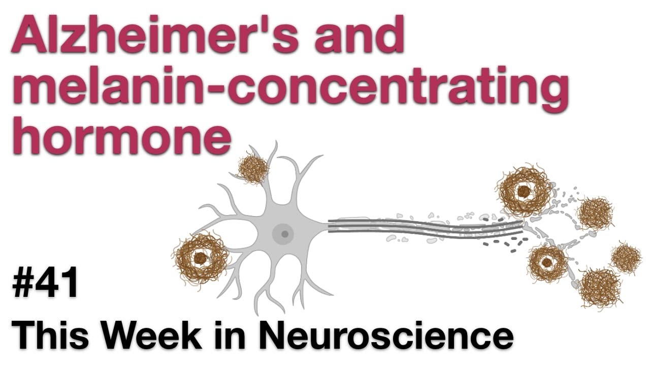 TWiN 41: Alzheimer's and melanin-concentrating hormone