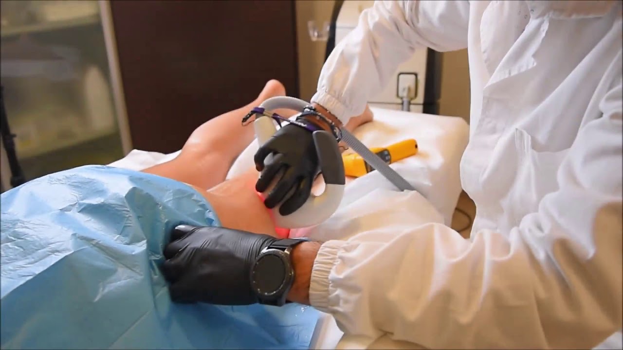 Trattamento cosce e glutei con laser NIR