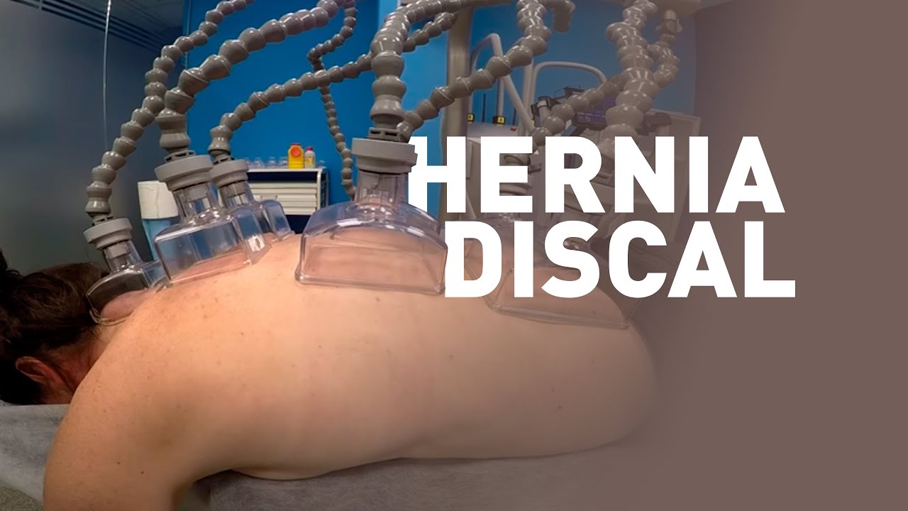 Tratamientos Richelli’s | Hernia discal en deporte de élite con Physium System