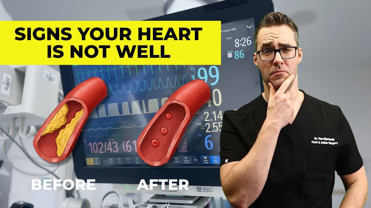9 Signs You Have Clogged Arteries & Heart Problems [+7 Treatments]