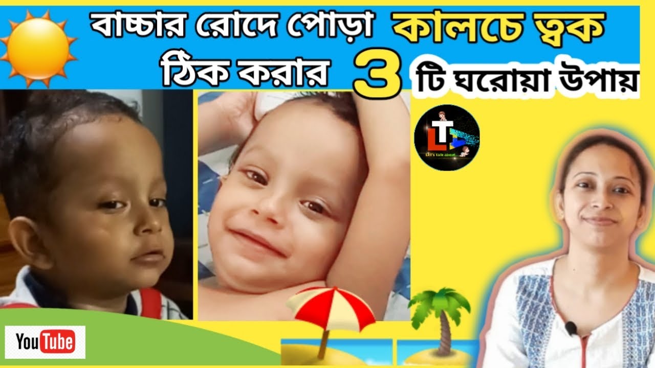 Baby Skin Care in Summer To Remove Sun Tan || Home Remedy to Make Baby Fair || Summer Baby Care