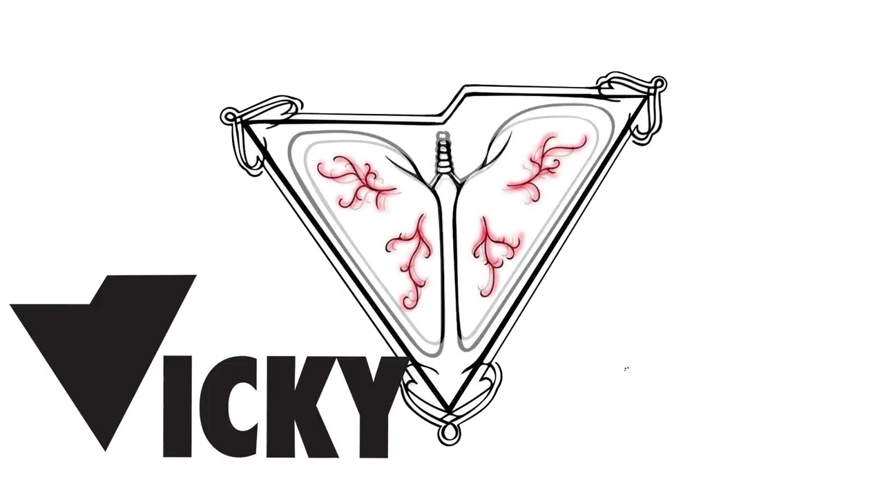 Vicky - Anda