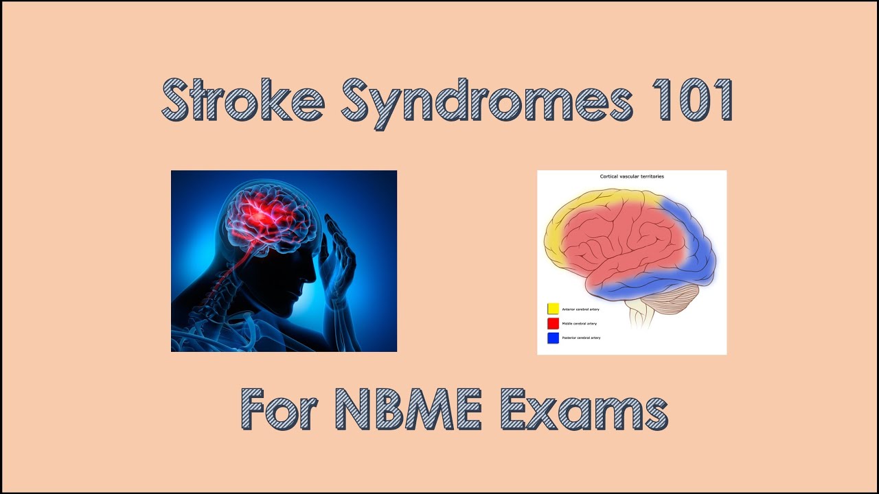 Обзор синдрома инсульта 101 для экзаменов NBME