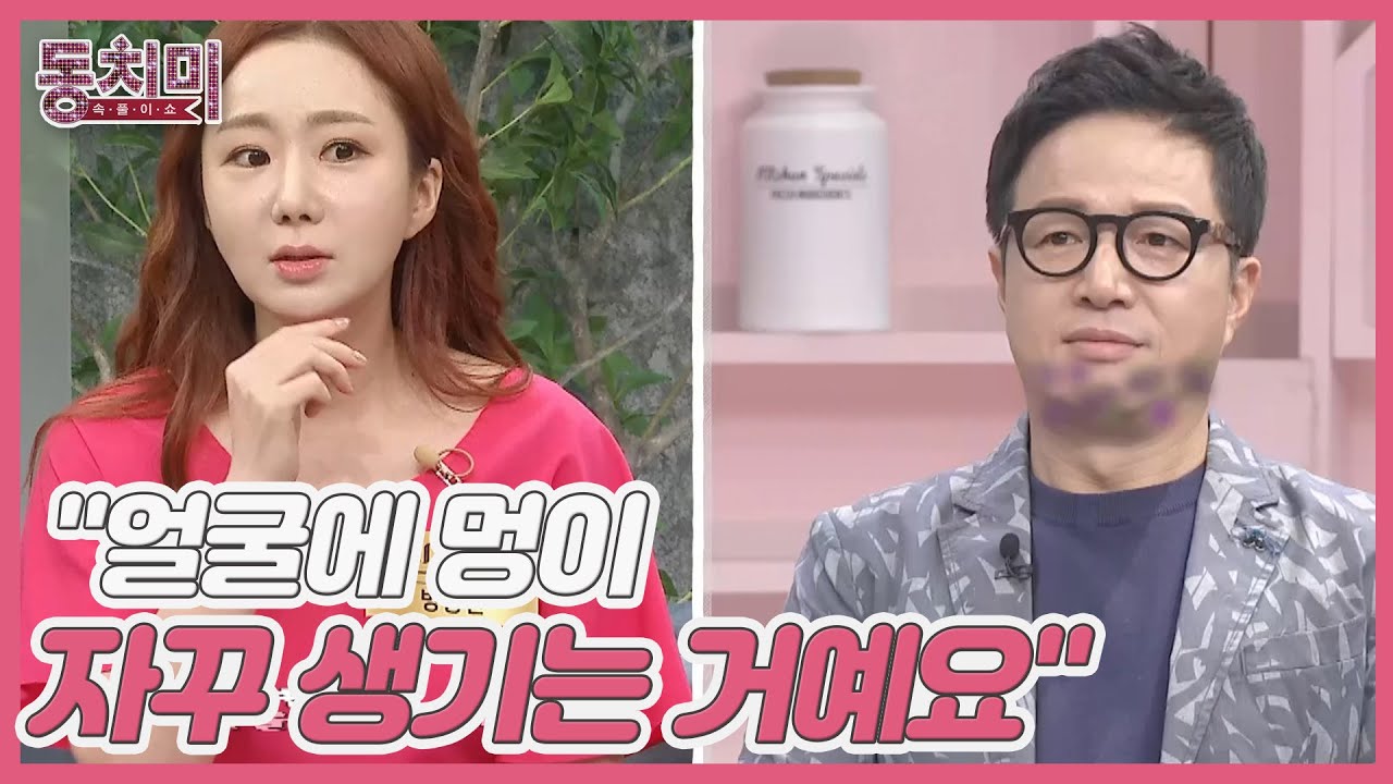 조영구 아내 신재은, 두드려 맞고 다니는 조영구? ＂얼굴에 멍이 자꾸 생기는 거예요＂ MBN 220917 방송
