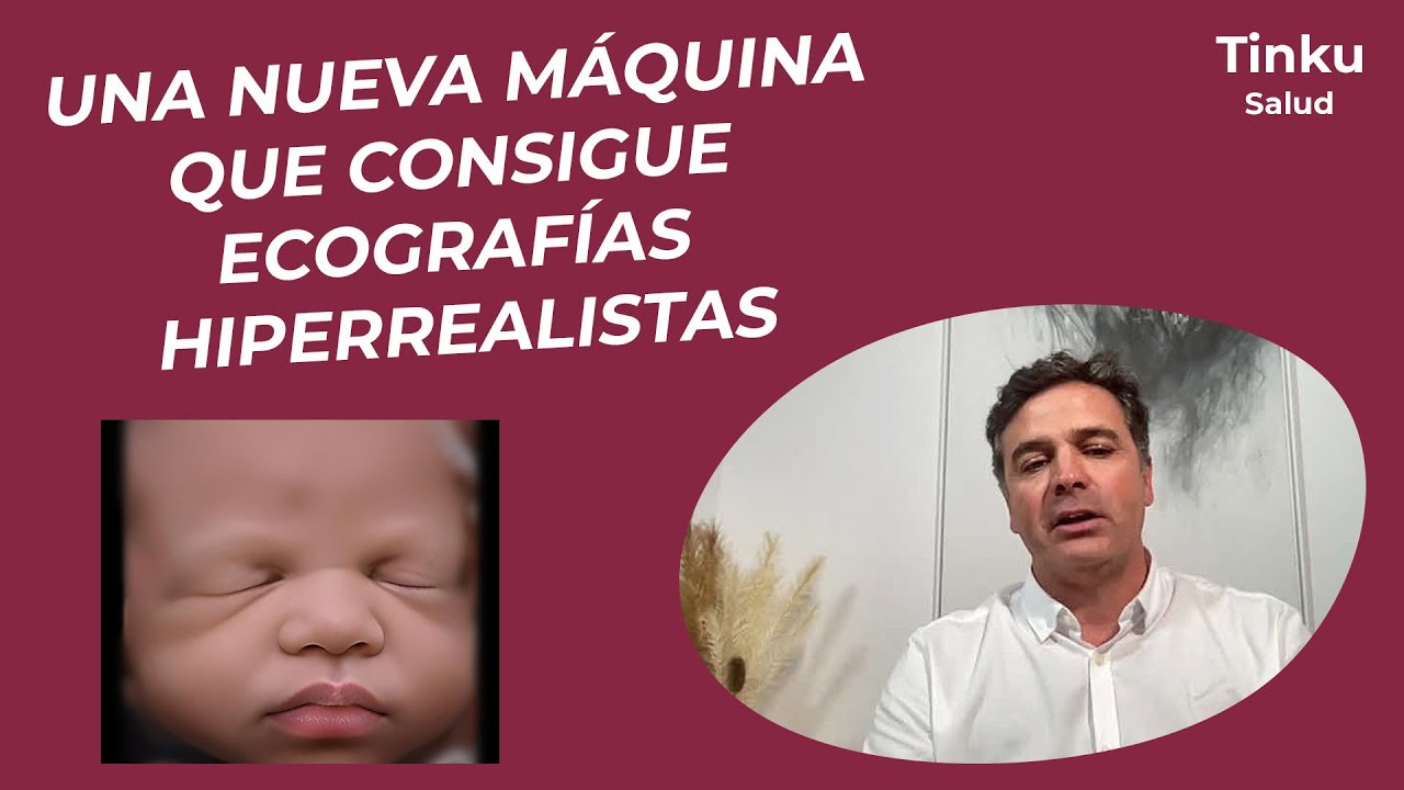 Una nueva máquina que consigue ecografías hiperrealistas