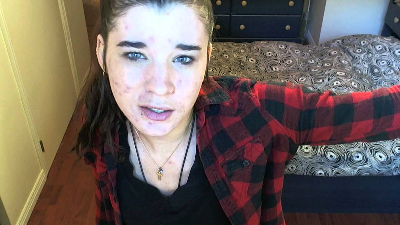 MelshBitch contre LAIDS humains