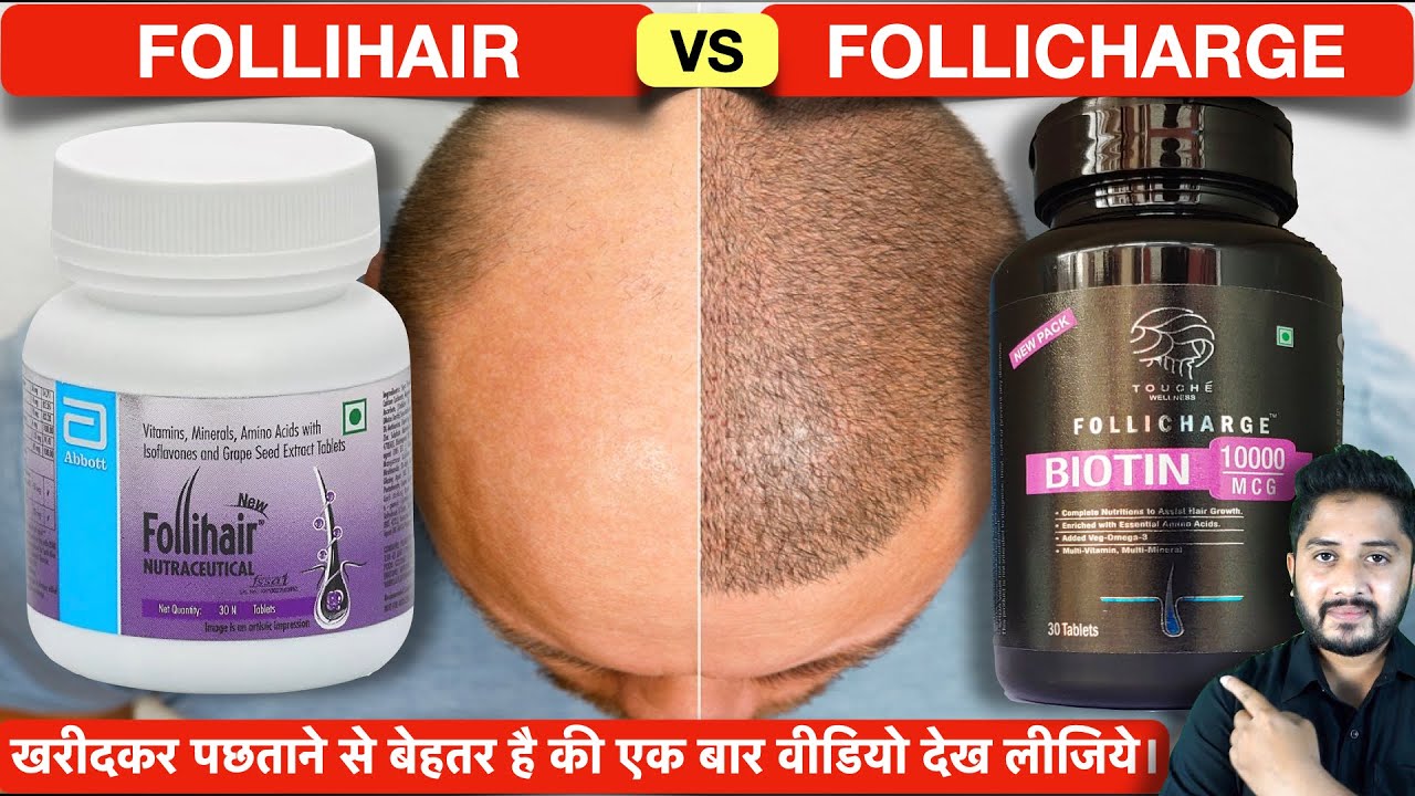 FOLLIHAR vs FOLLICHARGE Review: Hair के लिए कौन सी Multivitamin Tablet सबसे Best है?
