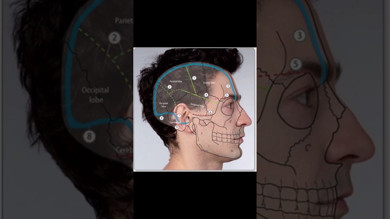 Surface marking of pterion, Parotid duct and gland 