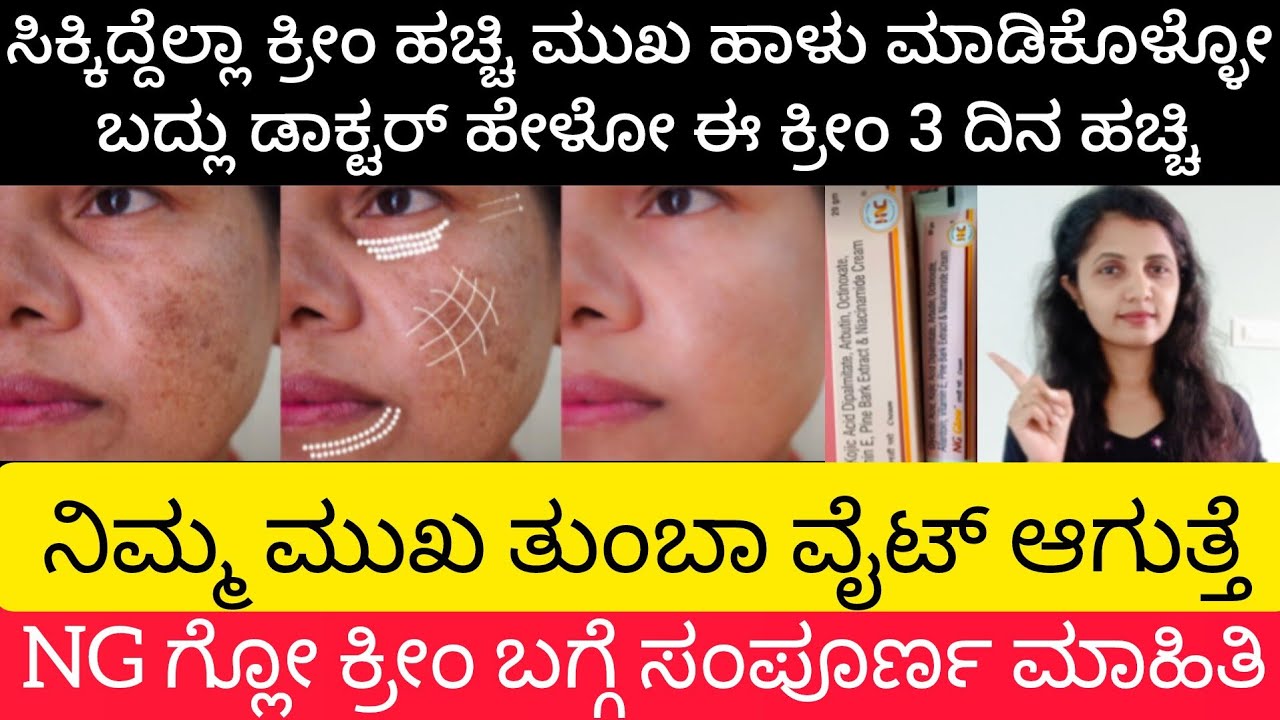 ಮುಖದಲ್ಲಿರುವ melasma,pigmentation,ಮೊಡವೆ ಕಲೆ,ಕಪ್ಪು ಕಲೆ,Age spot, uneven skin ಗೆ ಬೆಸ್ಟ್ ಕ್ರೀಂ ಇದೇ ನೋಡಿ👆