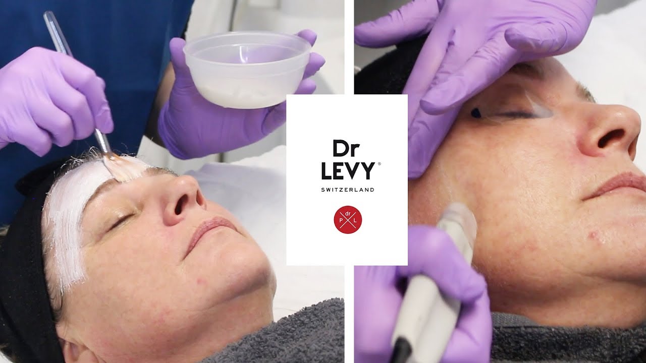 Microdermabrasion with Dr Levy | The Laser and Skin Clinic