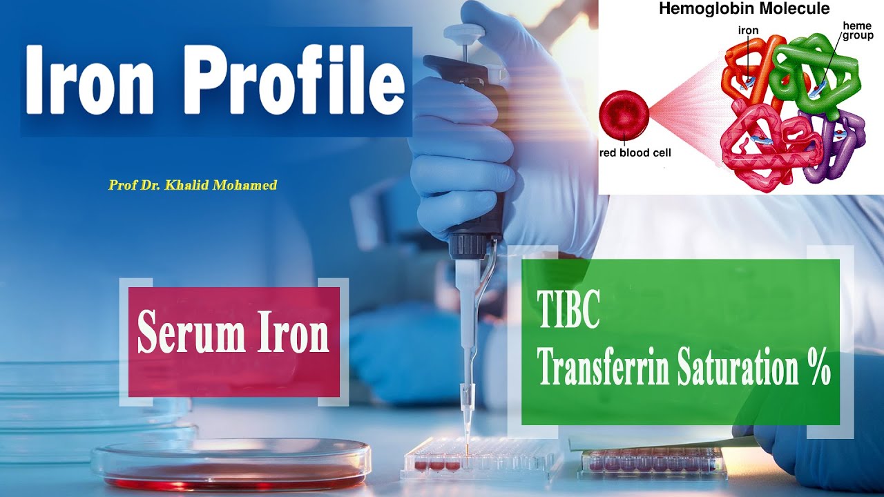 Iron profile test تحاليل الحديد