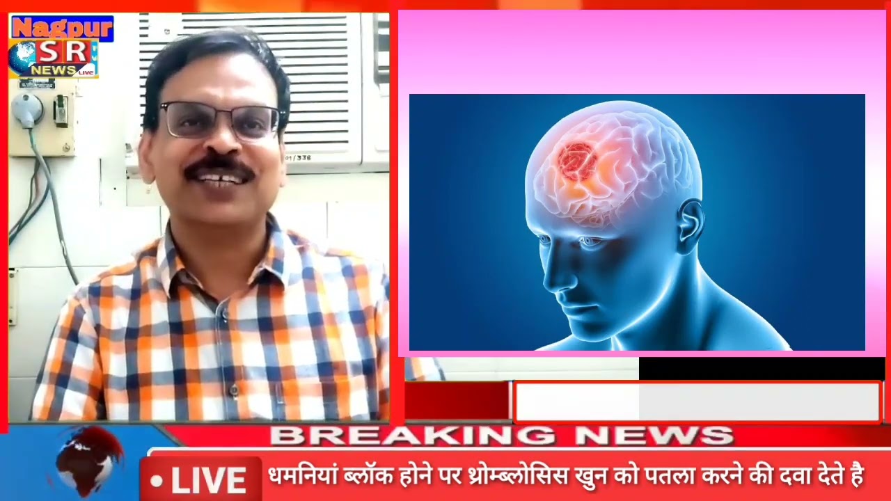 #srtv news live#Dr Nitin Chandak#मष्तिष्क को इन्जुयूरी से सेफ रखते हुए 'वर्ल्ड ब्रेन डे' मनाया