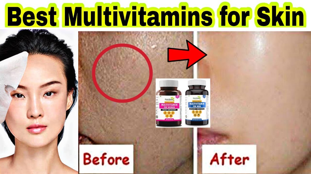 Best multivitamin tablets for skin and hair & Health| Pigmentation| Skin care| Nutriown| Men & Women